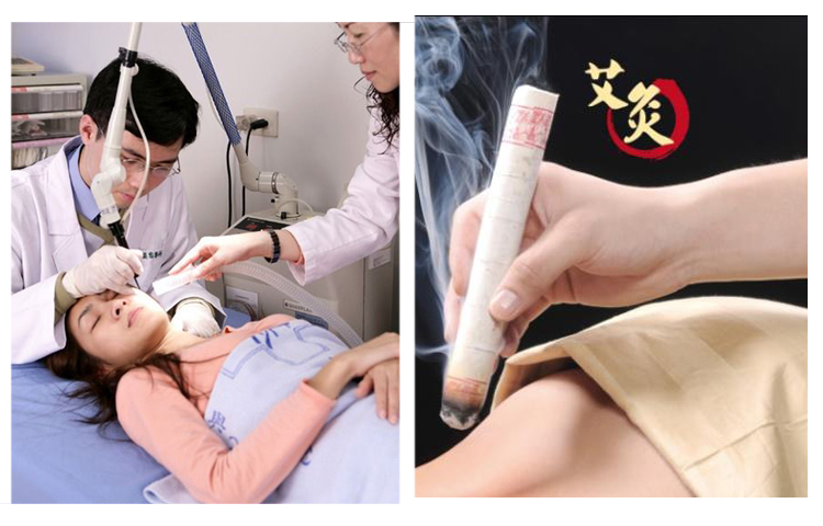 艾灸煙霧凈化器 艾灸煙霧凈化器